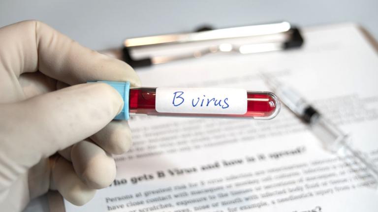 Muestra de sangre contagiada con el virus B