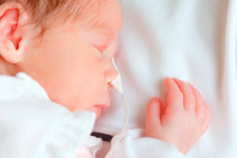 Bebé prematuro en el hospital con asistencia respiratoria