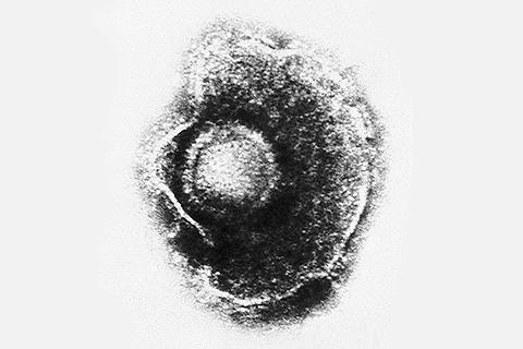 Reactivación del virus de la varicela-zóster