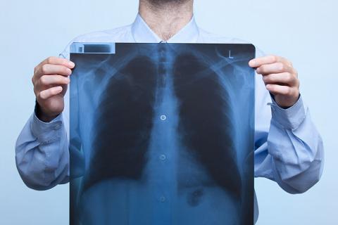 Diagnóstico de tromboembolismo pulmonar
