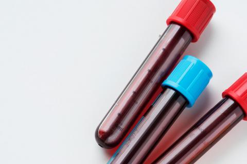 Análisis de sangre, tubos de ensayo