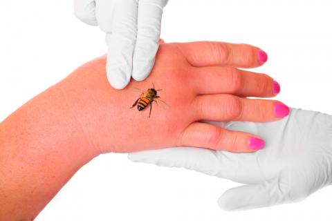 Doctor sujetando la mano del paciente mientras la abeja inocula su veneno
