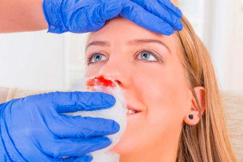 Un sanitario atiende a una joven con hemorragia nasal