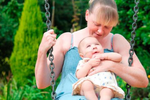 Madre con bebé con síntomas del síndrome de Patau