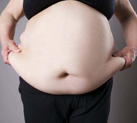 Obesidad abdominal