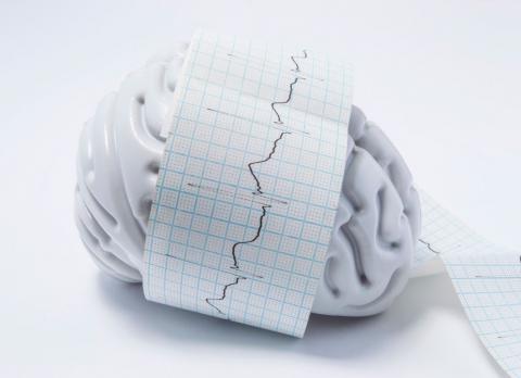 Ilustración cerebral de tipos de crisis epilépticas