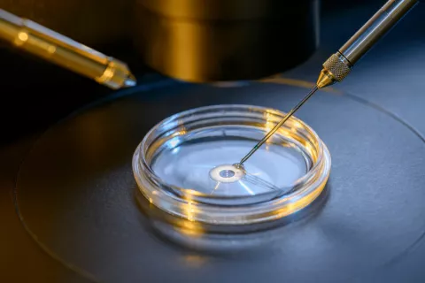 Fecundación in vitro