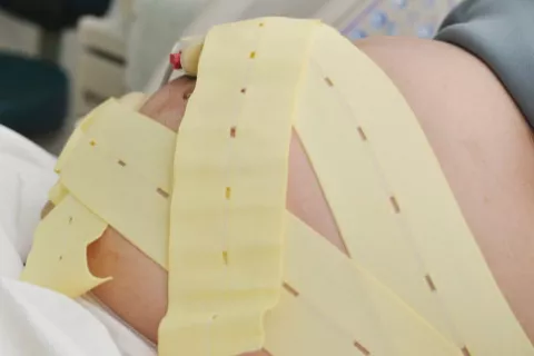 Tipos de monitorización fetal