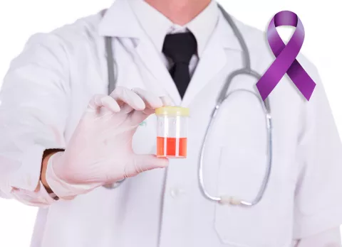 Sangre en la orina como señal de cáncer en adultos mayores Sangre en la orina como consecuencia del cáncer