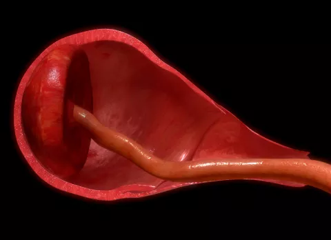 Problemas que pueden afectar a la placenta Problemas de la placenta