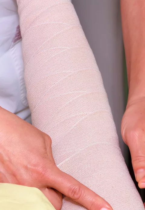 Linfedema tras el cáncer de mama