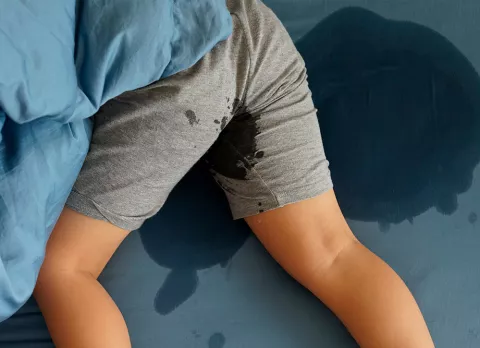 Tratamiento de la poliuria en la infancia y signos de alarma Tratamiento de la poliuria en la infancia