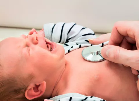 Neumonía neonatal, infección pulmonar en recién nacidos Neumonía neonatal
