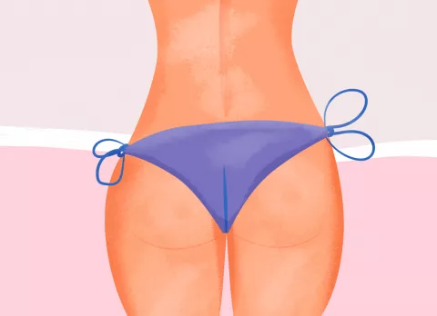 Brazilian butt lift, riesgos del aumento de glúteos Ilustración de unos glúteos de mujer