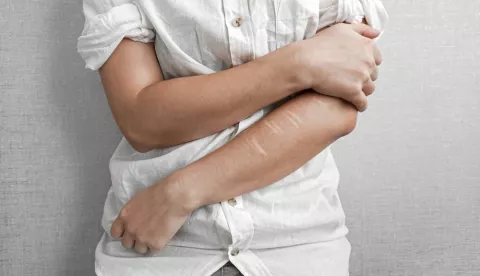Adolescente que se ha hecho daño a sí mismo Adolescente con marcas de autolesiones en el brazo