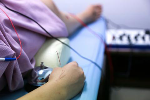 leninismo Contiene Concurso Cómo se hace un electromiograma - Pruebas médicas