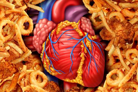 Componentes nutricionales desaconsejados para enfermos cardiacos