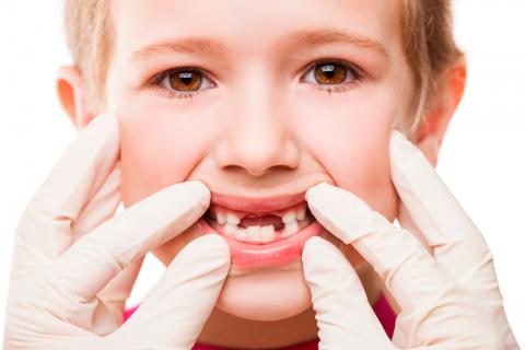 Diferencias entre la dentición temporal y la definitiva
