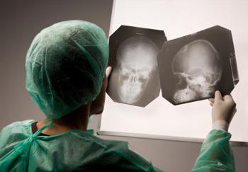 Un médico observa los resultados de pruebas de imagen para diagnosticar una conmoción cerebral