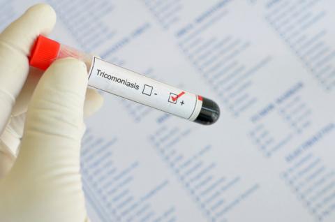 Detección de la tricomoniasis