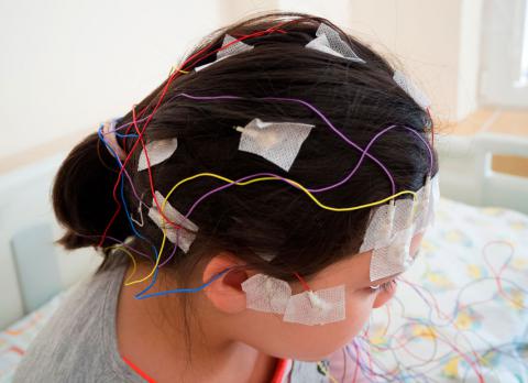 Diagnóstico de la epilepsia con EEG