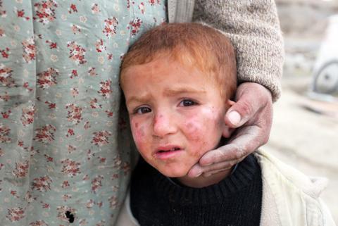 Niño después de haber sufrido un terremoto