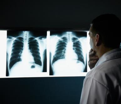 Doctor analizando las radiografías de un paciente