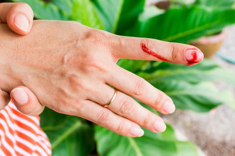 Hemorragia en un dedo, síntoma de la hemofilia