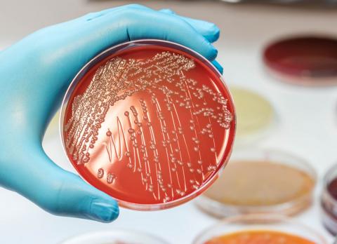 Bacteria E. coli en el laboratorio