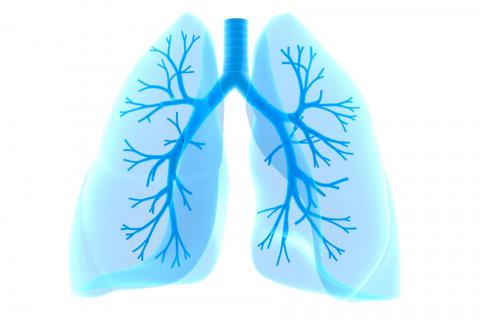 Qué es el cáncer de pulmón