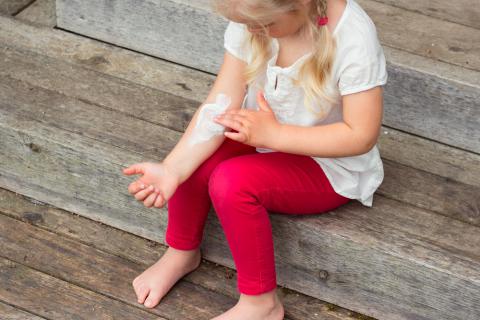 Dermatitis atópica en una niña