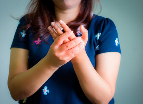 Mujer con una hinchazón en las manos debido a la esclerodermia