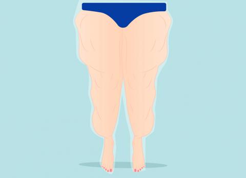 Pierde grasimea arata mai mare Slăbitul din greutate Vs. slăbitul din grăsime | Care e diferența?