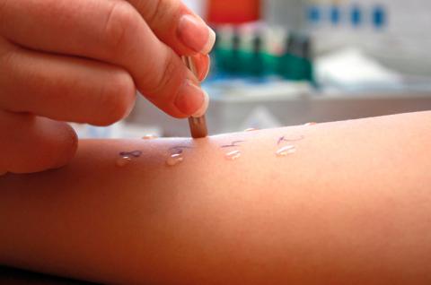 Prick test: pruebas cutáneas de alergia, cómo son - Pruebas Médicas
