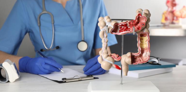 Gastroenterólogo con un modelo de colon humano en la mesa