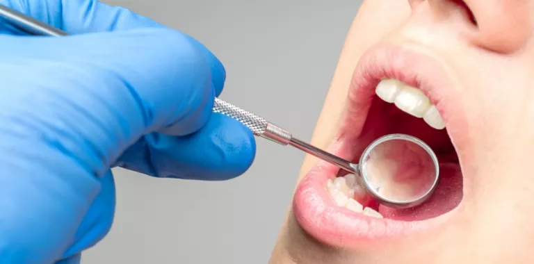 Mano del dentista examina boca paciente con espejo dental