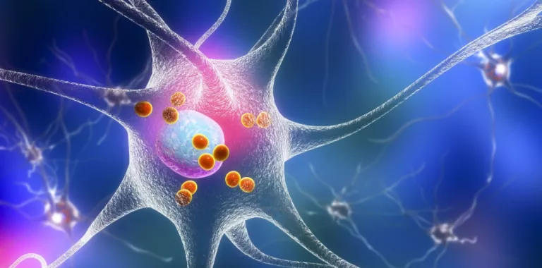 Ilustración en 3D de neuronas que se degeneran por enfermedad de Parkinson