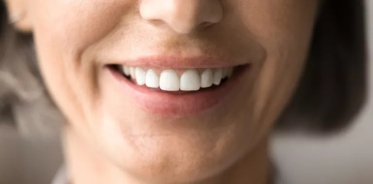 Mujer de mediana edad sonríe mostrando un saludable y blanco esmalte dental
