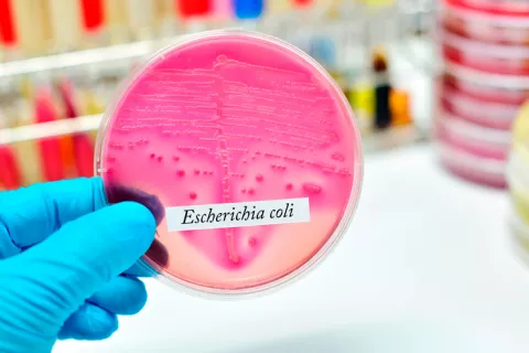 Cultivo de la bacteria 'E. coli' en el laboratorio