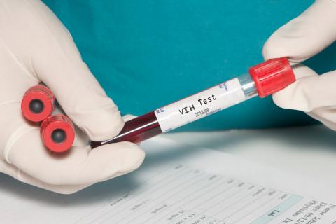 Prueba de VIH y terapia de células madre