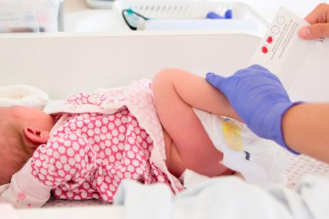 Prueba a un bebé para detectar la fenilcetonuria