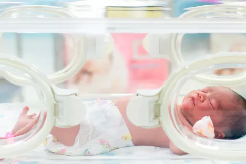 Una mutación en un gen podría provocar el parto prematuro Bebé prematuro