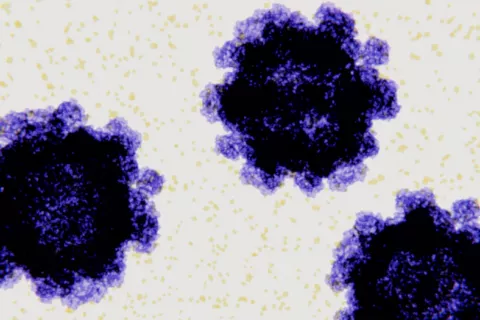 Hallan un potente anticuerpo que inhibe múltiples cepas de norovirus Cepas de norovirus