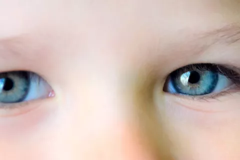 Anomalías en la pupila y el ritmo cardíaco pueden indicar autismo Niño con anomalía en la pupila que puede indicar autismo
