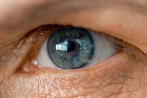 Retina del ojo de una persona con alzhéimer