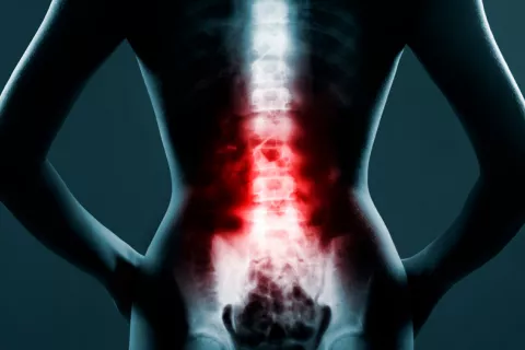 Sanidad autoriza NC1, un fármaco español para las lesiones medulares Lesiones medulares