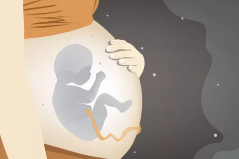 Asocian contaminación en el embarazo con más riesgo de TDAH y autismo Embarazo y contaminación más riesgo de autismo y TDAH