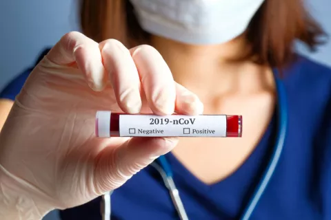 Positivo para coronavirus de Wuhan