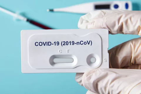 Sanidad planea realizar más test rápidos de diagnóstico del COVID-19 Sanidad planea realizar más test de diagnóstico del COVID-19