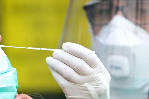 Cuándo y a quién se harán los test rápidos para detectar el COVID-19 Test rápidos para detectar el coronavirus